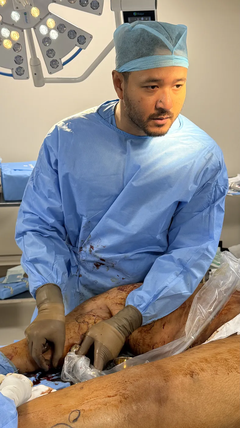 Dr. Sanjit Gogoi during endovenous laser ablation for varicose veins